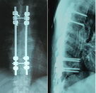 X blu asciutto 8 x del film di imaging biomedico di Ray a 10 pollici per Agfa/Fuji