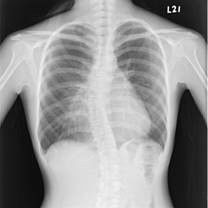 Good price Pollice asciutto medico basso bianco X12 del film 10 del laser X Ray degradabile in linea
