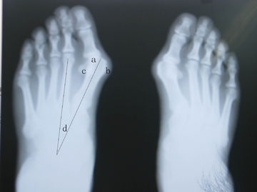 Good price Rappresentazione impermeabile di sistema diagnostico di X Ray in linea