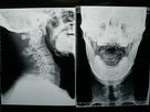 Good price Film ad alta densità X Ray di imaging biomedico asciutto per Fuji 3000/2000/1000 in linea