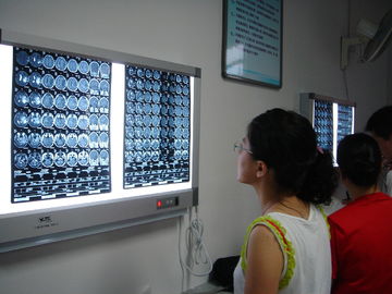 Good price Film asciutto medico asciutto 10in x 12in di X Ray del laser per le stampanti di Fuji in linea