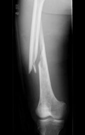 Good price Imaging biomedico del laser X Ray di Konida in linea