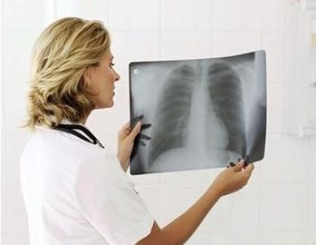 Good price il film diagnostico medico della rappresentazione del laser di 25cm x di 20 assottiglia impermeabile in linea