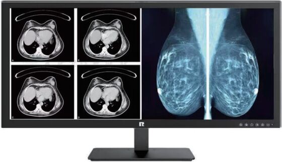 Prezzo buono High Definition Medical Display For Precision Medical Imaging And Healthcare Monitoring in linea