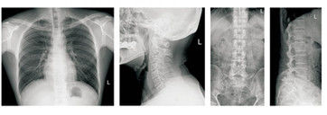Attrezzatura mobile ad alta frequenza della radiografia di Digital, attrezzatura medica portatile di X Ray