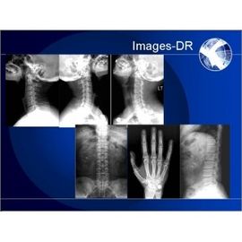Good price Macchina della radiografia di Digital dei RAGGI X di Mammogrpahy con il braccio flessibile del UC in linea