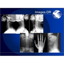 Macchina della radiografia di Digital dei RAGGI X di Mammogrpahy con il braccio flessibile del UC