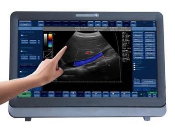 Good price Portatile medico del sistema di ultrasuono di doppler di colore 3D/4D con il monitor a 15 pollici del LED in linea