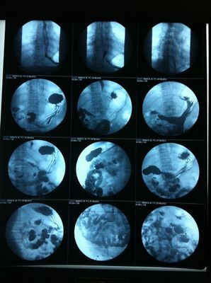 Good price Stampa traslucida dello schermo del getto di inchiostro X Ray Film Glossy Surface Silk in linea
