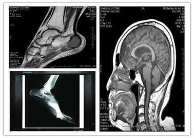 Good price Film asciutto basso blu medico di rappresentazione di Digital ricerca compatibile di 10in x di 8 Hosipital Mri in linea