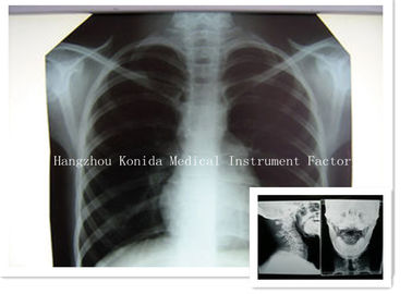 Film radiografico di X Ray di Digital del film 14 x 17inch di rappresentazione asciutta medica di salute