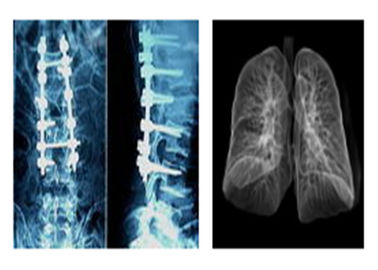 Lastre radioscopiche mediche radiografiche taglienti, film di Dott. Ct Digital Dry Imaging di Mri