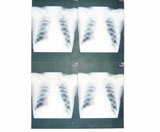Good price Film medico basso bianco della carta di X Ray a prova d'umidità per la stampante a laser di Sony/EPSON in linea