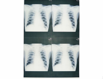 rappresentazione diagnostica medica di 25cm x di 20cm, carta del film X Ray della stampante a laser