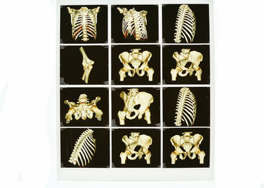 Good price Rappresentazione diagnostica bianca portabile della base X Ray, lastra radioscopica medica del blu del laser in linea