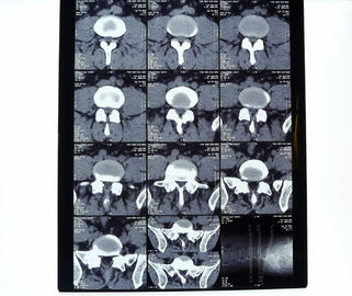 10in * 12in film asciutti di imaging biomedico ad alta densità di 14in * di 11in per la stampante Fuji/di AGFA