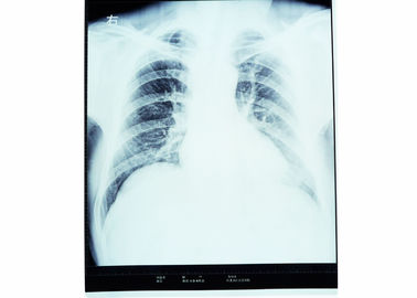qualità Film asciutto KND-A/KND-F di imaging biomedico della nebbia bassa per le stampanti termiche fabbrica