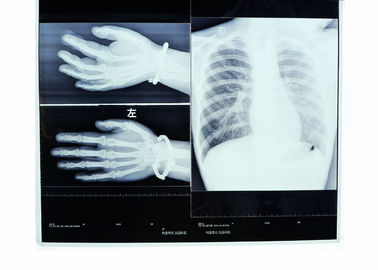 Film asciutto 14 x 17 Konida di imaging biomedico X Ray, ad alta densità