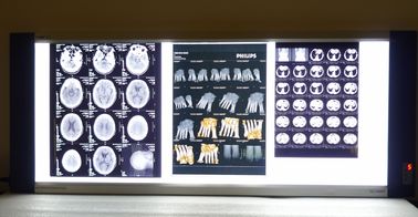 Good price Base asciutta medica luminosa del blu del laser del film della stampante termica di X Ray in linea