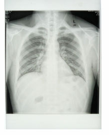 Good price Le lastre radioscopiche medica della stampante a laser Di Konida CE di 14in x di 11in KND-K hanno approvato in linea