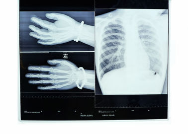 Good price Nebbie bassa film asciutto della stampante termica della trasparenza dei raggi x di imaging biomedico di 17in * di 14in in linea