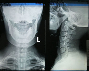 qualità film asciutto medico lucido di rappresentazione di 43cm * di 35cm per Fuji 3000, 2000, 1000, stampante termica fabbrica