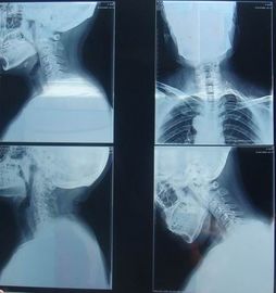 Good price Film asciutto di carta medico Graffio-resistente di rappresentazione di KND-K per esame radiografico in linea
