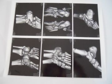 Good price Film asciutto medico di rappresentazione per l'esame di X Ray su AGFA 5300, 5302, 5500 in linea