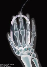 Film asciutto di imaging biomedico della trasparenza, lastra radioscopica termica di Agfa Digital