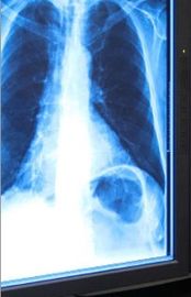 Good price Film asciutto 11in x 17in di imaging biomedico dei raggi x blu per la stampante termica in linea